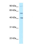 SHCBP1L / C1orf14 Antibody - SHCBP1L antibody Western blot of Jurkat Cell lysate. Antibody concentration 1 ug/ml.  This image was taken for the unconjugated form of this product. Other forms have not been tested.