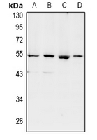 SHD Antibody - Western blot analysis of SHD expression in LO2 (A), HEK293T (B), A549 (C), PC12 (D) whole cell lysates.