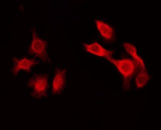 SHD Antibody - Staining HepG2 cells by IF/ICC. The samples were fixed with PFA and permeabilized in 0.1% Triton X-100, then blocked in 10% serum for 45 min at 25°C. The primary antibody was diluted at 1:200 and incubated with the sample for 1 hour at 37°C. An Alexa Fluor 594 conjugated goat anti-rabbit IgG (H+L) Ab, diluted at 1/600, was used as the secondary antibody.