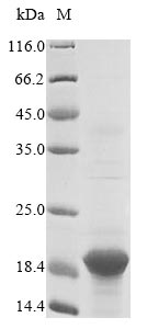 B2M / Beta 2 Microglobulin Protein - (Tris-Glycine gel) Discontinuous SDS-PAGE (reduced) with 5% enrichment gel and 15% separation gel.