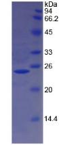 HBB / Hemoglobin Beta Protein - Recombinant Hemoglobin Beta By SDS-PAGE