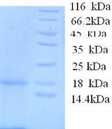 IL-1B / IL-1 Beta Protein