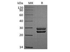 PRL / Prolactin Protein - Recombinant Sheep Prolactin/PRL (C-6His)