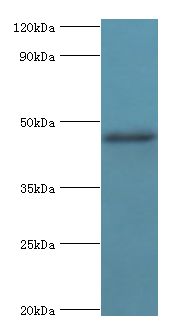 SHFM3 / FBXW4 Antibody - Western blot. All lanes: FBXW4 antibody at 4 ug/ml+mouse skeletal muscle tissue. Secondary antibody: Goat polyclonal to rabbit at 1:10000 dilution. Predicted band size: 46 kDa. Observed band size: 46 kDa Immunohistochemistry.