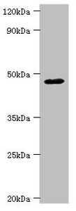 SHFM3 / FBXW4 Antibody - Western blot All lanes: FBXW4 antibody at 4µg/ml + Mouse skeletal muscle tissue Secondary Goat polyclonal to rabbit IgG at 1/10000 dilution Predicted band size: 46 kDa Observed band size: 46 kDa