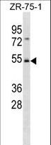 SHFM3 / FBXW4 Antibody - FBXW4 Antibody western blot of ZR-75-1 cell line lysates (35 ug/lane). The FBXW4 antibody detected the FBXW4 protein (arrow).