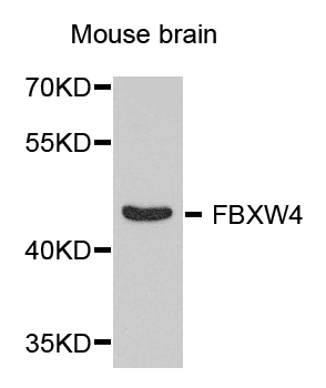 SHFM3 / FBXW4 Antibody - Western blot analysis of extract of various cells.