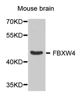 SHFM3 / FBXW4 Antibody - Western blot analysis of extract of various cells.