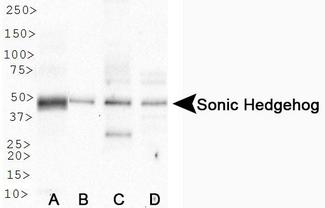 SHH / Sonic Hedgehog Antibody - Western Blot: Sonic Hedgehog Antibody - WB detection of Sonic Hedgehog in A. human stomach, B. human fetal liver membrane, C. PC12 and D. Cos7