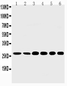 SHH / Sonic Hedgehog Antibody - Sonic Hedgehog antibody Western blot. Lane 1: Rat Liver Tissue Lysate. Lane 2: Rat Intestine Tissue Lysate. Lane 3: HELA Cell Lysate. Lane 4: A549 Cell Lysate. Lane 5: SMMC Cell Lysate. Lane 6: MM231 Cell Lysate.