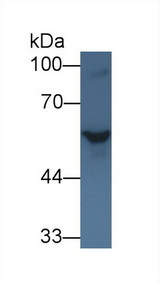 SHH / Sonic Hedgehog Antibody - Western Blot; Sample: Rat Serum; Primary Ab: 1µg/ml Rabbit Anti-Rat SHH Antibody Second Ab: 0.2µg/mL HRP-Linked Caprine Anti-Rabbit IgG Polyclonal Antibody