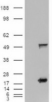 SHH / Sonic Hedgehog Antibody - HEK293T cells were transfected with the pCMV6-ENTRY control (Left lane) or pCMV6-ENTRY SHH (Right lane) cDNA for 48 hrs and lysed. Equivalent amounts of cell lysates (5 ug per lane) were separated by SDS-PAGE and immunoblotted with anti-SHH.