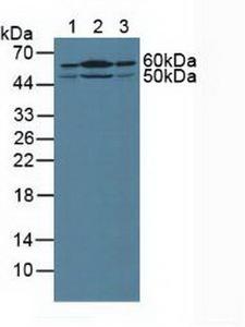 SHH / Sonic Hedgehog Antibody - Western Blot; Sample: Lane1: Human Liver Tissue; Lane2: Mouse Kidney Tissue; Lane3: Human PANC-1 Cells.