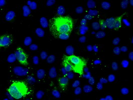 SHH / Sonic Hedgehog Antibody - Anti-SHH mouse monoclonal antibody immunofluorescent staining of COS7 cells transiently transfected by pCMV6-ENTRY SHH.