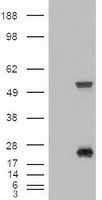 SHH / Sonic Hedgehog Antibody - HEK293T cells were transfected with the pCMV6-ENTRY control (Left lane) or pCMV6-ENTRY SHH (Right lane) cDNA for 48 hrs and lysed. Equivalent amounts of cell lysates (5 ug per lane) were separated by SDS-PAGE and immunoblotted with anti-SHH.