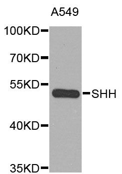 SHH / Sonic Hedgehog Antibody - Western blot analysis of extracts of A-549 cells, using SHH antibody at 1:1000 dilution. The secondary antibody used was an HRP Goat Anti-Rabbit IgG (H+L) at 1:10000 dilution. Lysates were loaded 25ug per lane and 3% nonfat dry milk in TBST was used for blocking. An ECL Kit was used for detection and the exposure time was 90s.