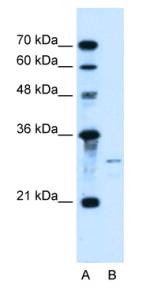 SHH / Sonic Hedgehog Antibody - Western analysis of SHH in HepG2 cell lysate.  This image was taken for the unconjugated form of this product. Other forms have not been tested.