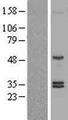 SHH / Sonic Hedgehog Protein - Western validation with an anti-DDK antibody * L: Control HEK293 lysate R: Over-expression lysate