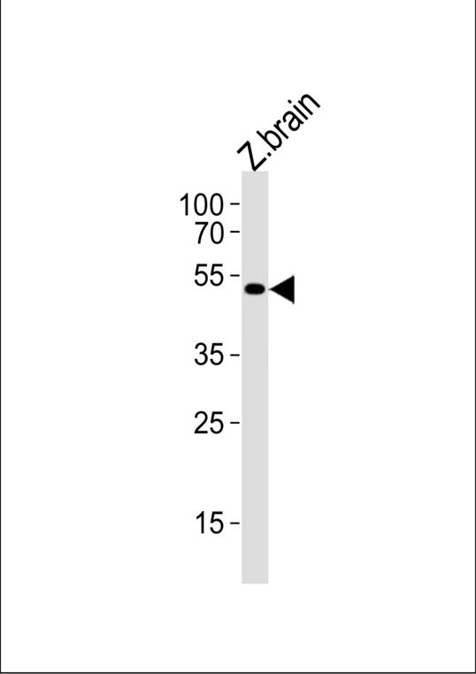 shha Antibody - Shha Antibody western blot of zebrafish brain tissue lysate (35 ug/lane). This demonstrates that the (DANRE) shha antibody detected zebrafish shha protein (arrow).