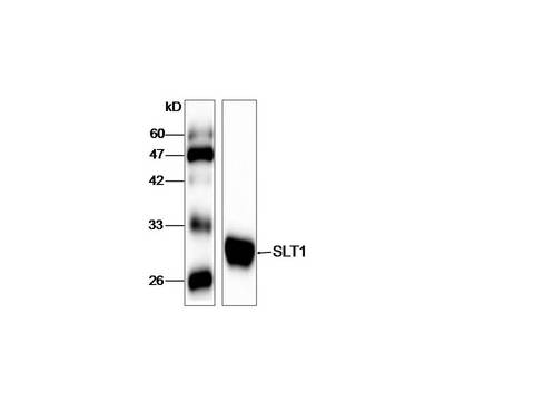 Shiga-Like Toxin 1 Subunit A Antibody