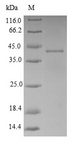 Adenylate Kinase Protein - (Tris-Glycine gel) Discontinuous SDS-PAGE (reduced) with 5% enrichment gel and 15% separation gel.