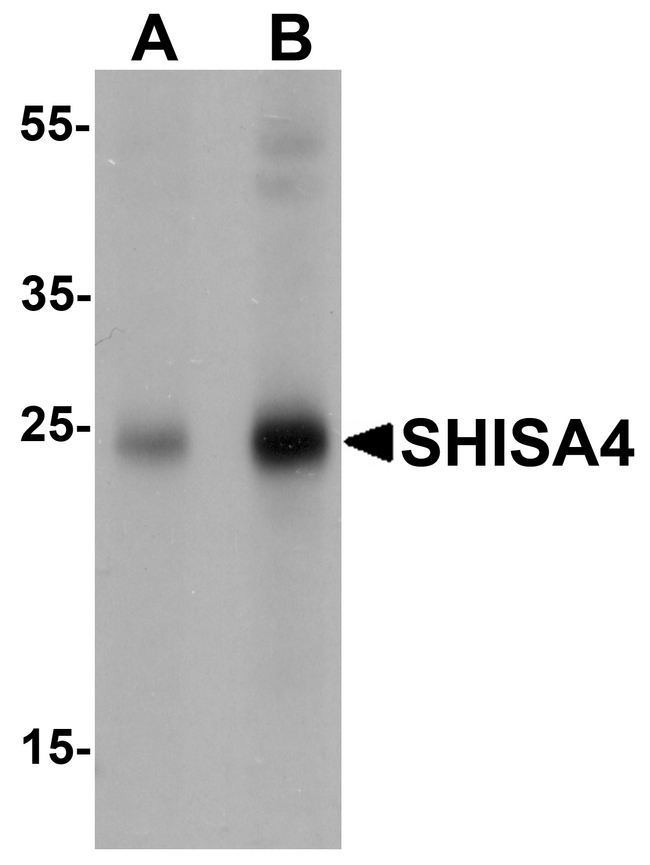 SHISA4 Antibody - Western blot analysis of SHISA4 in human brain tissue lysate with SHISA4 antibody at (A) 1 and (B) 2 ug/ml.