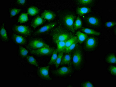 SHISA5 / SCOTIN Antibody - Immunofluorescence staining of A549 cells with SHISA5 Antibody at 1:200, counter-stained with DAPI. The cells were fixed in 4% formaldehyde, permeabilized using 0.2% Triton X-100 and blocked in 10% normal Goat Serum. The cells were then incubated with the antibody overnight at 4°C. The secondary antibody was Alexa Fluor 488-congugated AffiniPure Goat Anti-Rabbit IgG(H+L).