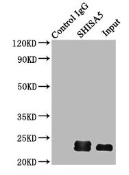 SHISA5 / SCOTIN Antibody - Immunoprecipitating SHISA5 in HepG2 whole cell lysate Lane 1: Rabbit control IgG (1µg) instead of SHISA5 Antibody in HepG2 whole cell lysate.For western blotting, a HRP-conjugated Protein G antibody was used as the secondary antibody (1/2000) Lane 2: SHISA5 Antibody (6µg) + HepG2 whole cell lysate (500µg) Lane 3: HepG2 whole cell lysate (10µg)