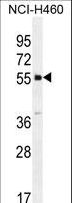 SHISA6 Antibody - SHISA6 Antibody western blot of NCI-H460 cell line lysates (35 ug/lane). The SHISA6 antibody detected the SHISA6 protein (arrow).