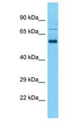 SHISA7 Antibody - SHISA7 antibody Western Blot of OVCAR-3. Antibody dilution: 1 ug/ml.  This image was taken for the unconjugated form of this product. Other forms have not been tested.