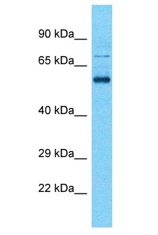 SHISA7 Antibody - SHISA7 antibody Western Blot of OVCAR-3. Antibody dilution: 1 ug/ml.  This image was taken for the unconjugated form of this product. Other forms have not been tested.