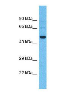 SHISA9 Antibody - Western blot of Human Fetal Liver. SHISA9 antibody dilution 1.0 ug/ml.  This image was taken for the unconjugated form of this product. Other forms have not been tested.