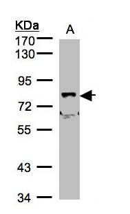 SHKBP1 Antibody - Sample (30 ug of whole cell lysate). A: A431, B: H1299. 7.5% SDS PAGE. SHKBP1 antibody diluted at 1:500