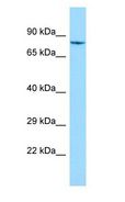SHKBP1 Antibody - SHKBP1 antibody Western Blot of HepG2.  This image was taken for the unconjugated form of this product. Other forms have not been tested.