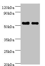 SHMT / SHMT1 Antibody - Western blot All lanes: SHMT1 antibody at 7µg/ml Lane 1: Hela whole cell lysate Lane 2: HepG2 whole cell lysate Secondary Goat polyclonal to rabbit IgG at 1/10000 dilution Predicted band size: 54, 50, 45, 38 kDa Observed band size: 54 kDa