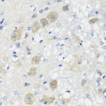 SHMT / SHMT1 Antibody - Immunohistochemistry of paraffin-embedded rat brain tissue.