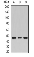 SHMT / SHMT1 Antibody - Western blot analysis of SHMT1 expression in HepG2 (A); MCF7 (B); HeLa (C) whole cell lysates.