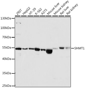 SHMT / SHMT1 Antibody - Western blot analysis of extracts of various cell lines, using SHMT1 antibody at 1:1000 dilution. The secondary antibody used was an HRP Goat Anti-Rabbit IgG (H+L) at 1:10000 dilution. Lysates were loaded 25ug per lane and 3% nonfat dry milk in TBST was used for blocking. An ECL Kit was used for detection and the exposure time was 10s.