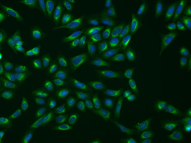 SHMT / SHMT1 Antibody - Immunofluorescence staining of SHMT1 in U2OS cells. Cells were fixed with 4% PFA, permeabilzed with 0.1% Triton X-100 in PBS, blocked with 10% serum, and incubated with rabbit anti-Human SHMT1 polyclonal antibody (dilution ratio 1:200) at 4°C overnight. Then cells were stained with the Alexa Fluor 488-conjugated Goat Anti-rabbit IgG secondary antibody (green) and counterstained with DAPI (blue). Positive staining was localized to Cytoplasm.