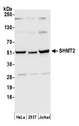 SHMT / SHMT2 Antibody - Detection of human SHMT2 by western blot. Samples: Whole cell lysate (50 µg) from HeLa, HEK293T, and Jurkat cells prepared using NETN lysis buffer. Antibody: Affinity purified rabbit anti-SHMT2 antibody used for WB at 0.1 µg/ml. Detection: Chemiluminescence with an exposure time of 10 seconds.