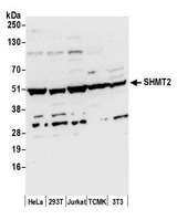 SHMT / SHMT2 Antibody - Detection of human and mouse SHMT2 by western blot. Samples: Whole cell lysate (50 µg) from HeLa, HEK293T, Jurkat, mouse TCMK-1, and mouse NIH 3T3 cells prepared using NETN lysis buffer. Antibody: Affinity purified rabbit anti-SHMT2 antibody used for WB at 0.1 µg/ml. Detection: Chemiluminescence with an exposure time of 10 seconds.