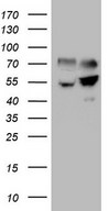 SHMT / SHMT2 Antibody - HEK293T cells were transfected with the pCMV6-ENTRY control. (Left lane) or pCMV6-ENTRY SHMT2. (Right lane) cDNA for 48 hrs and lysed. Equivalent amounts of cell lysates. (5 ug per lane) were separated by SDS-PAGE and immunoblotted with anti-SHMT2. (1:2000)