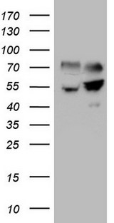 SHMT / SHMT2 Antibody - HEK293T cells were transfected with the pCMV6-ENTRY control. (Left lane) or pCMV6-ENTRY SHMT2. (Right lane) cDNA for 48 hrs and lysed