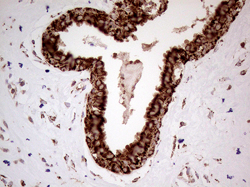 SHMT / SHMT2 Antibody - Immunohistochemical staining of paraffin-embedded Human breast tissue within the normal limits using anti-SHMT2 mouse monoclonal antibody. (Heat-induced epitope retrieval by 1mM EDTA in 10mM Tris buffer. (pH8.5) at 120°C for 3 min. (1:500)