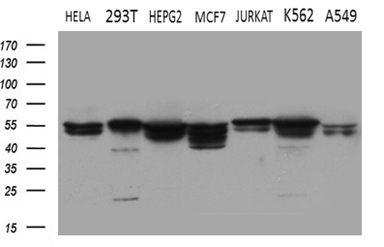 SHMT / SHMT2 Antibody - Western blot analysis of extracts. (35ug) from 7 different cell lines by using anti-SHMT2 monoclonal antibody. (1:500)