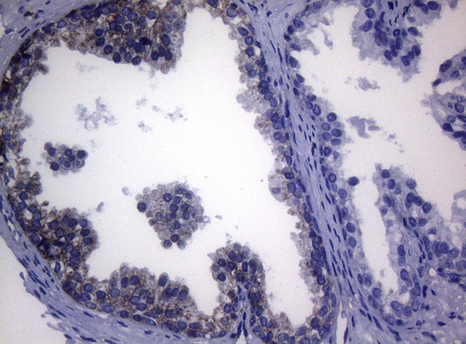 SHMT / SHMT2 Antibody - Immunohistochemical staining of paraffin-embedded Human prostate tissue within the normal limits using anti-SHMT2 mouse monoclonal antibody. (Heat-induced epitope retrieval by 1mM EDTA in 10mM Tris buffer. (pH8.5) at 120°C for 3 min. (1:150)