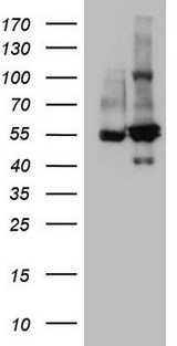 SHMT / SHMT2 Antibody - HEK293T cells were transfected with the pCMV6-ENTRY control. (Left lane) or pCMV6-ENTRY SHMT2. (Right lane) cDNA for 48 hrs and lysed