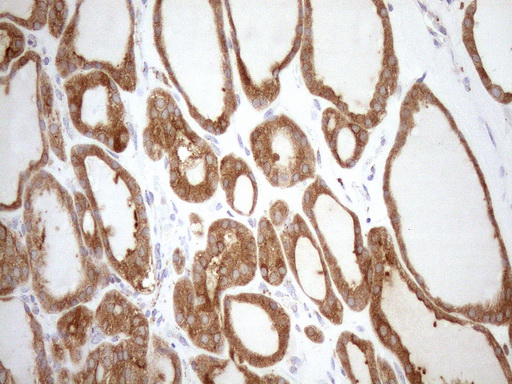 SHMT / SHMT2 Antibody - Immunohistochemical staining of paraffin-embedded Human thyroid tissue within the normal limits using anti-SHMT2 mouse monoclonal antibody. (Heat-induced epitope retrieval by 1mM EDTA in 10mM Tris buffer. (pH8.5) at 120°C for 3 min. (1:150)