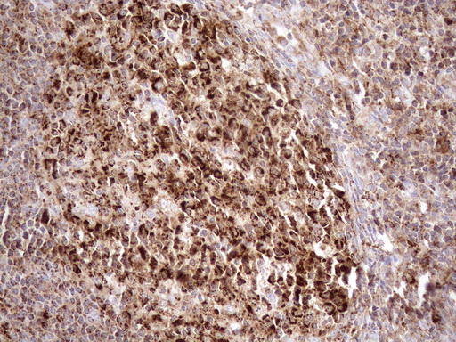 SHMT / SHMT2 Antibody - Immunohistochemical staining of paraffin-embedded Human tonsil within the normal limits using anti-SHMT2 mouse monoclonal antibody. (Heat-induced epitope retrieval by 1mM EDTA in 10mM Tris buffer. (pH8.5) at 120°C for 3 min. (1:150)