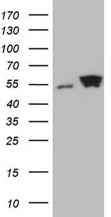 SHMT / SHMT2 Antibody - HEK293T cells were transfected with the pCMV6-ENTRY control. (Left lane) or pCMV6-ENTRY SHMT2. (Right lane) cDNA for 48 hrs and lysed